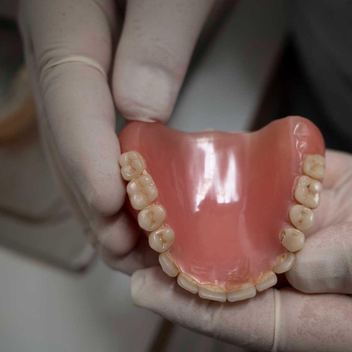Adesivo per ricostruzione dentale - Tutti i produttori di materiale medicale